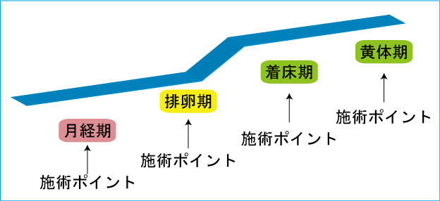 不妊鍼灸、体外受精、人工受精、顕微授精、IVF、ICSI