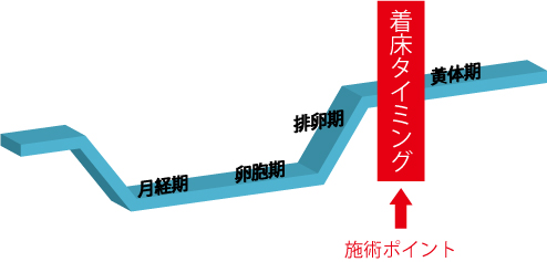 卵管内人工授精、AIH、着床率、不育、不妊